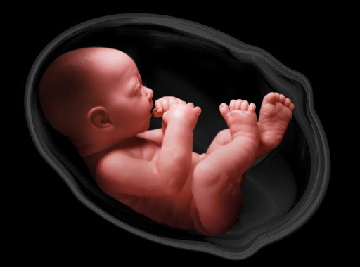 IVF